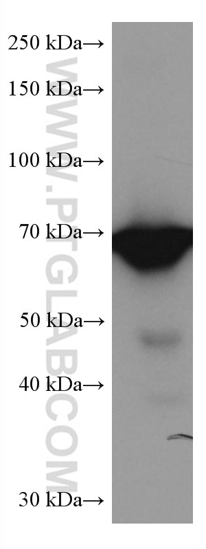 Western Blot (WB) analysis of human placenta tissue using GBP1 Monoclonal antibody (67161-1-Ig)