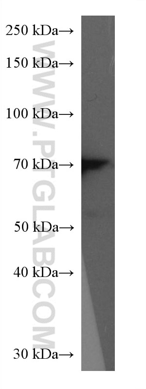 Western Blot (WB) analysis of rat spleen tissue using GBP1 Monoclonal antibody (67161-1-Ig)