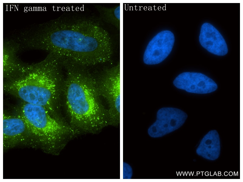 Immunofluorescence (IF) / fluorescent staining of HeLa cells using GBP1 Recombinant monoclonal antibody (83751-6-RR)