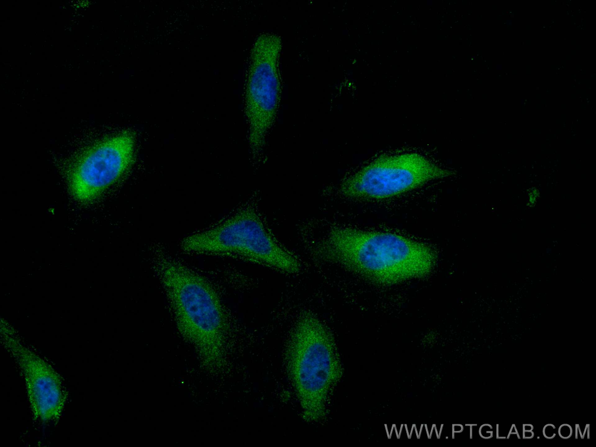 Immunofluorescence (IF) / fluorescent staining of HeLa cells using GBP2 Polyclonal antibody (11854-1-AP)
