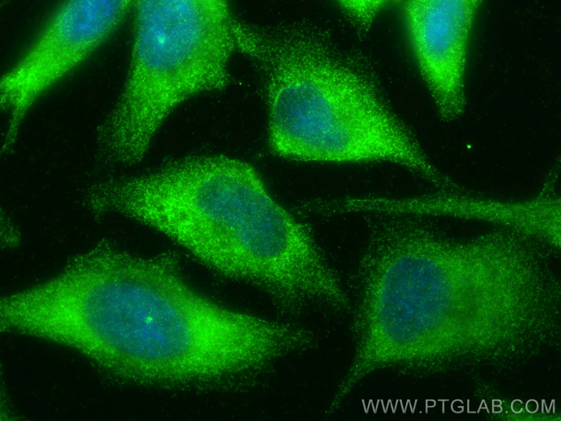 Immunofluorescence (IF) / fluorescent staining of HeLa cells using GBP2 Polyclonal antibody (11854-1-AP)