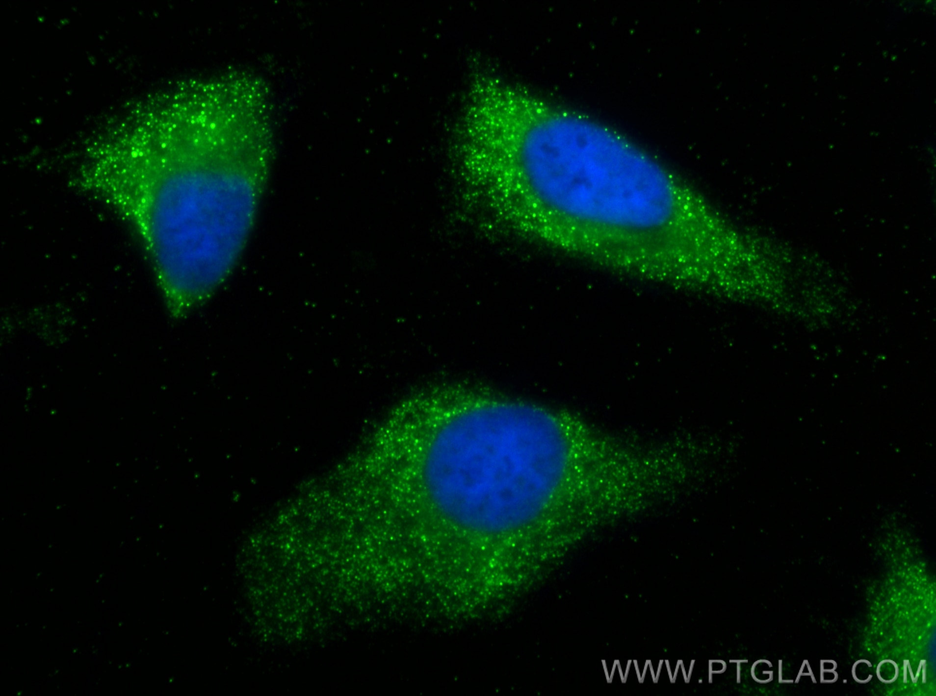 Immunofluorescence (IF) / fluorescent staining of HeLa cells using GBP2 Polyclonal antibody (11854-1-AP)
