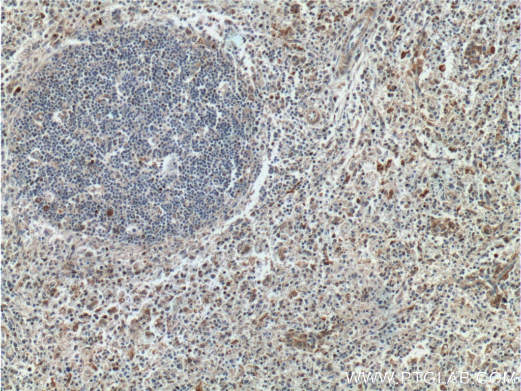 Immunohistochemistry (IHC) staining of human spleen tissue using GBP2 Polyclonal antibody (11854-1-AP)