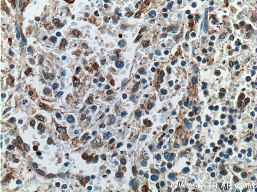 Immunohistochemistry (IHC) staining of human spleen tissue using GBP2 Polyclonal antibody (11854-1-AP)