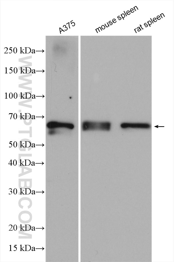 Western Blot (WB) analysis of various lysates using GBP2 Polyclonal antibody (11854-1-AP)