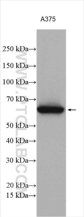 Western Blot (WB) analysis of various lysates using GBP2 Polyclonal antibody (11854-1-AP)
