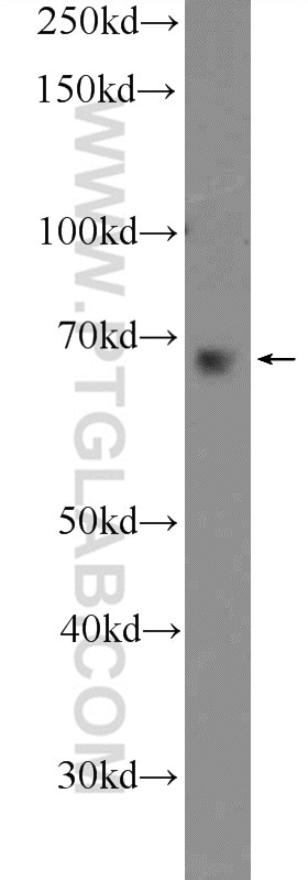 Western Blot (WB) analysis of K-562 cells using GBP2 Polyclonal antibody (11854-1-AP)