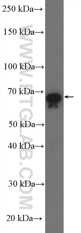 GBP2 Polyclonal antibody