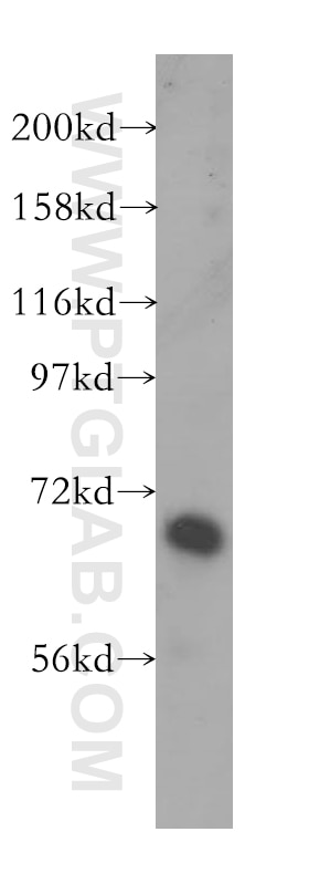 Western Blot (WB) analysis of human placenta tissue using GBP2 Polyclonal antibody (11854-1-AP)