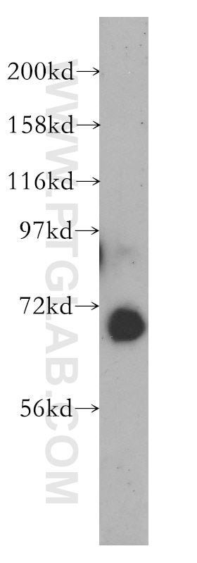 Western Blot (WB) analysis of human lung tissue using GBP2 Polyclonal antibody (11854-1-AP)