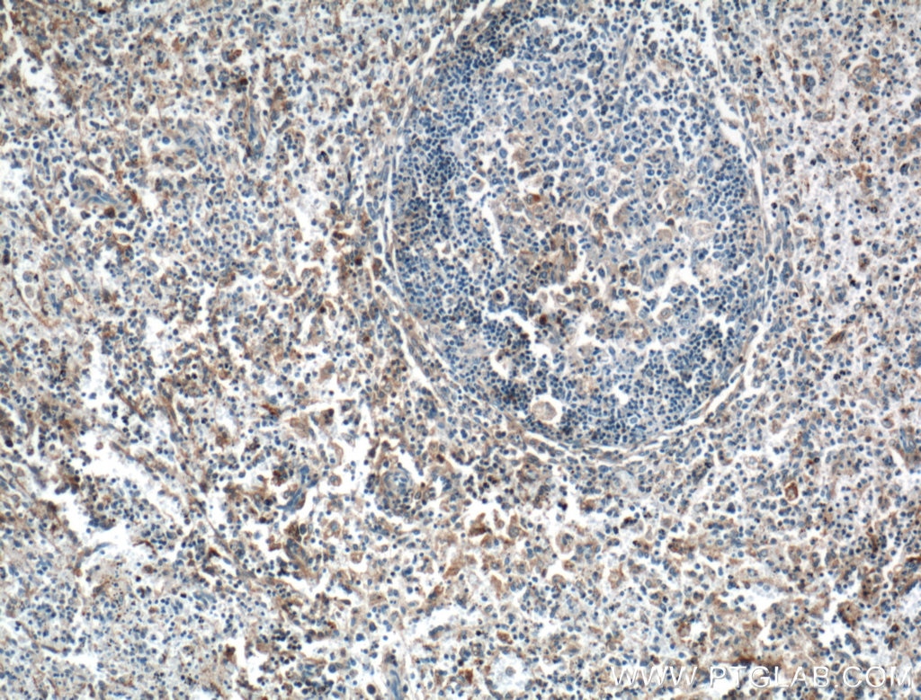 Immunohistochemistry (IHC) staining of human spleen tissue using GBP2 Polyclonal antibody (27299-1-AP)