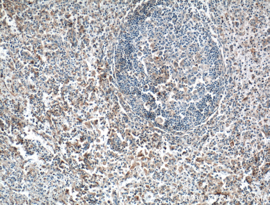 IHC staining of human spleen using 27299-1-AP