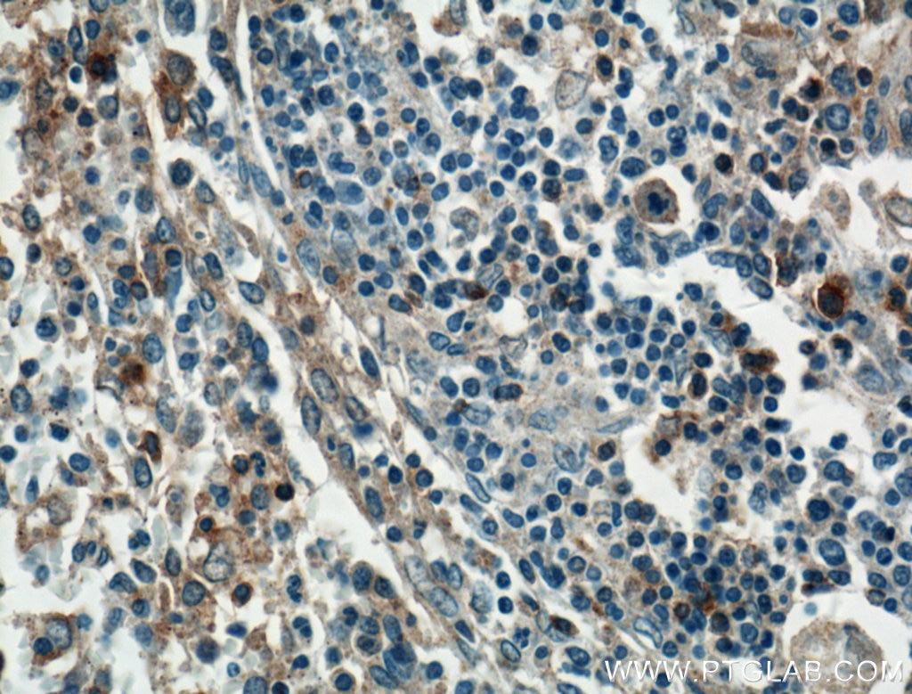 Immunohistochemistry (IHC) staining of human spleen tissue using GBP2 Polyclonal antibody (27299-1-AP)