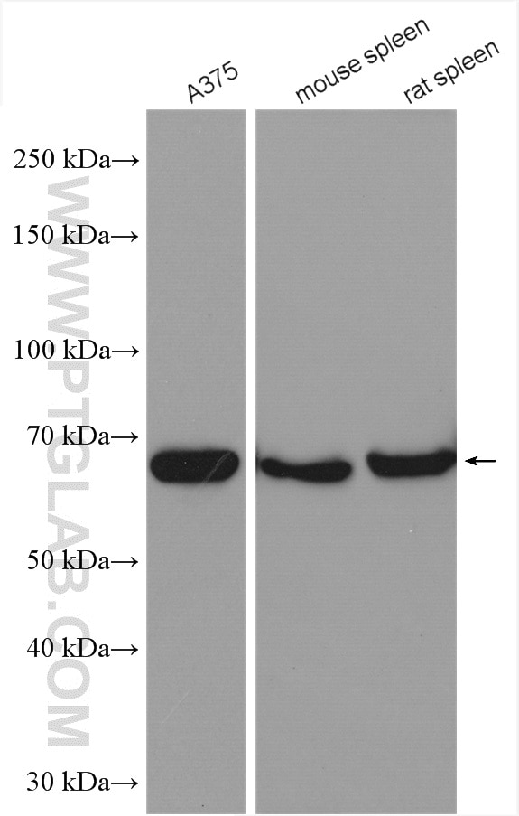Western Blot (WB) analysis of various lysates using GBP2 Polyclonal antibody (27299-1-AP)