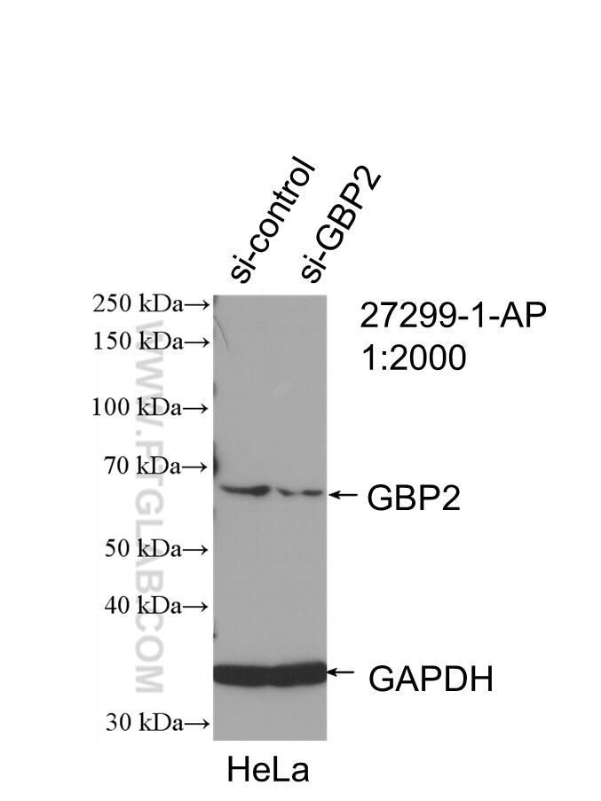 Western Blot (WB) analysis of HeLa cells using GBP2 Polyclonal antibody (27299-1-AP)