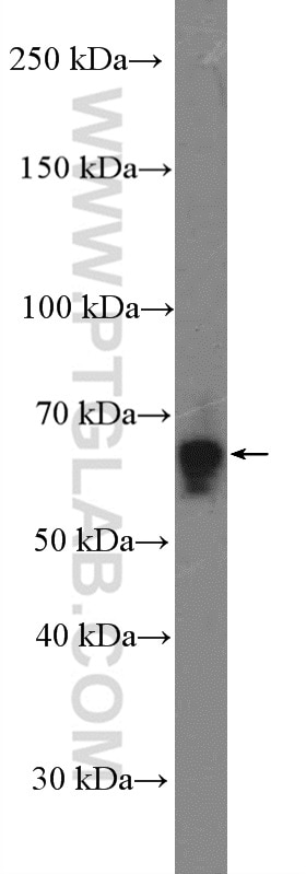 Western Blot (WB) analysis of HeLa cells using GBP2 Polyclonal antibody (27299-1-AP)