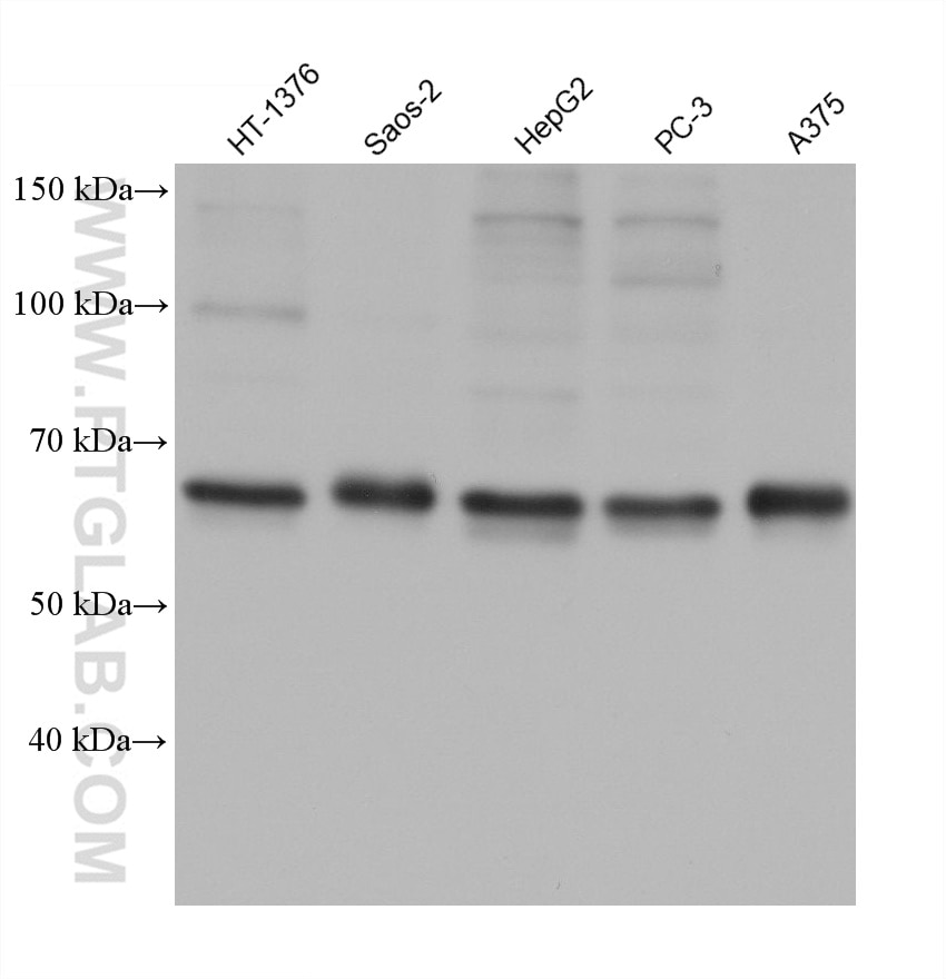 Western Blot (WB) analysis of various lysates using GBP2 Monoclonal antibody (68559-1-Ig)