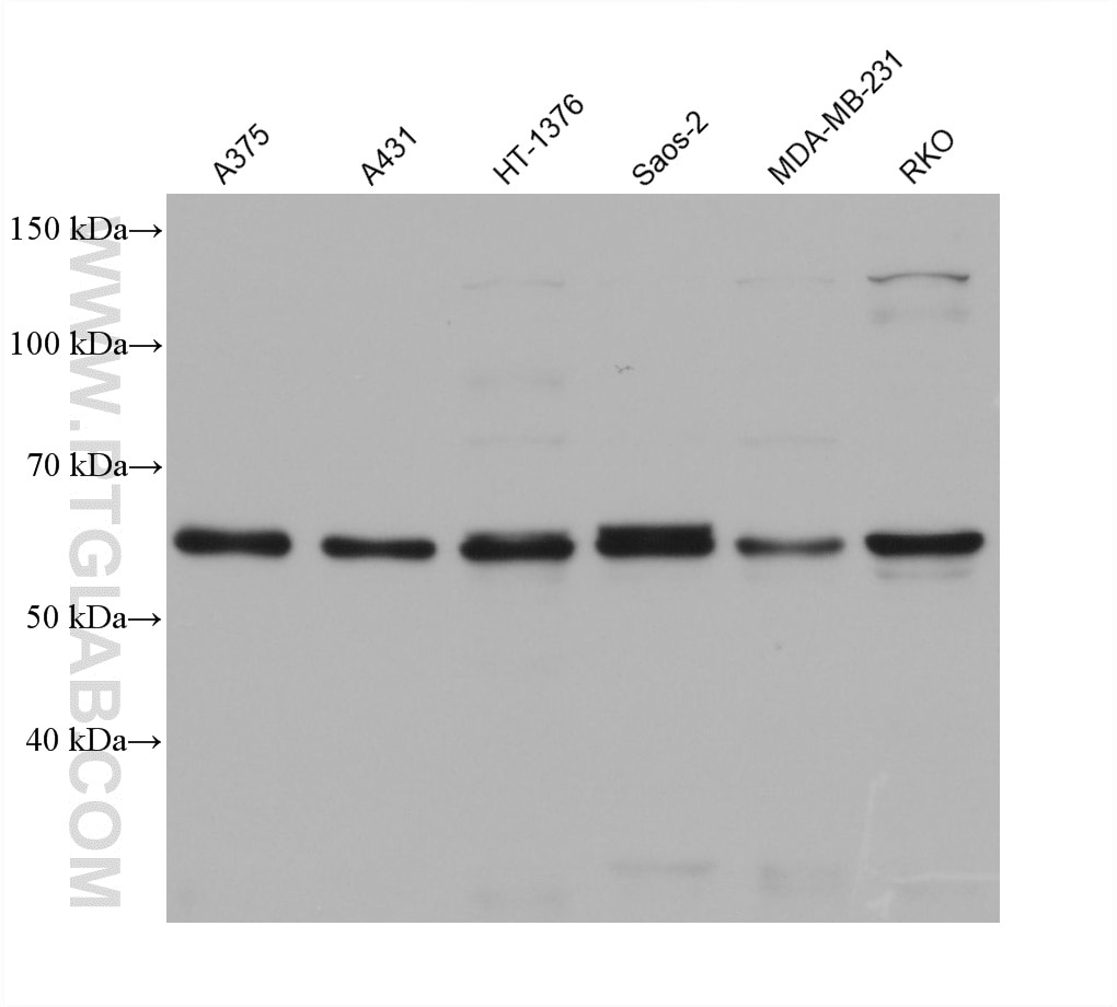 WB analysis using 68559-1-Ig (same clone as 68559-1-PBS) Western Blot (WB) analysis of various lysates using GBP2 Monoclonal antibody (68559-1-Ig)