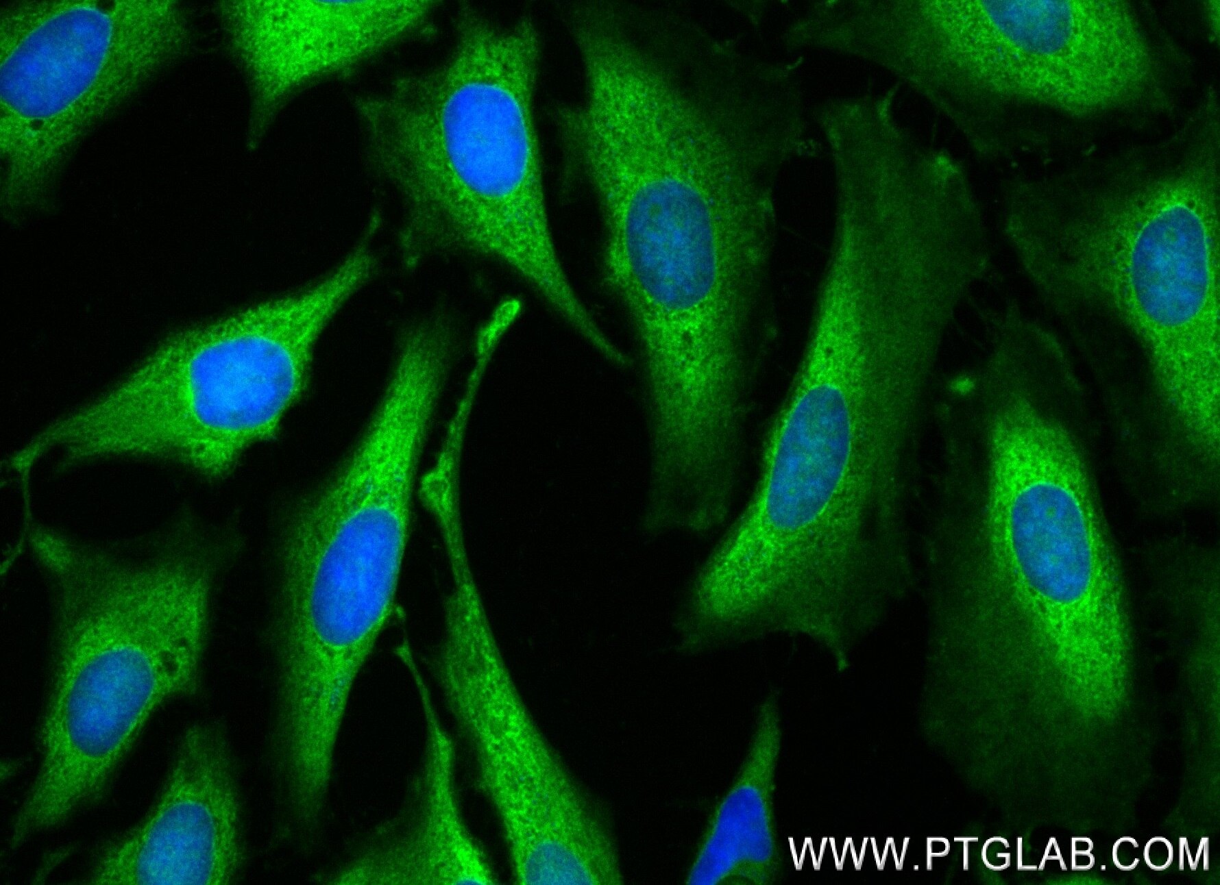 Immunofluorescence (IF) / fluorescent staining of HeLa cells using GBP2 Recombinant antibody (84264-6-RR)