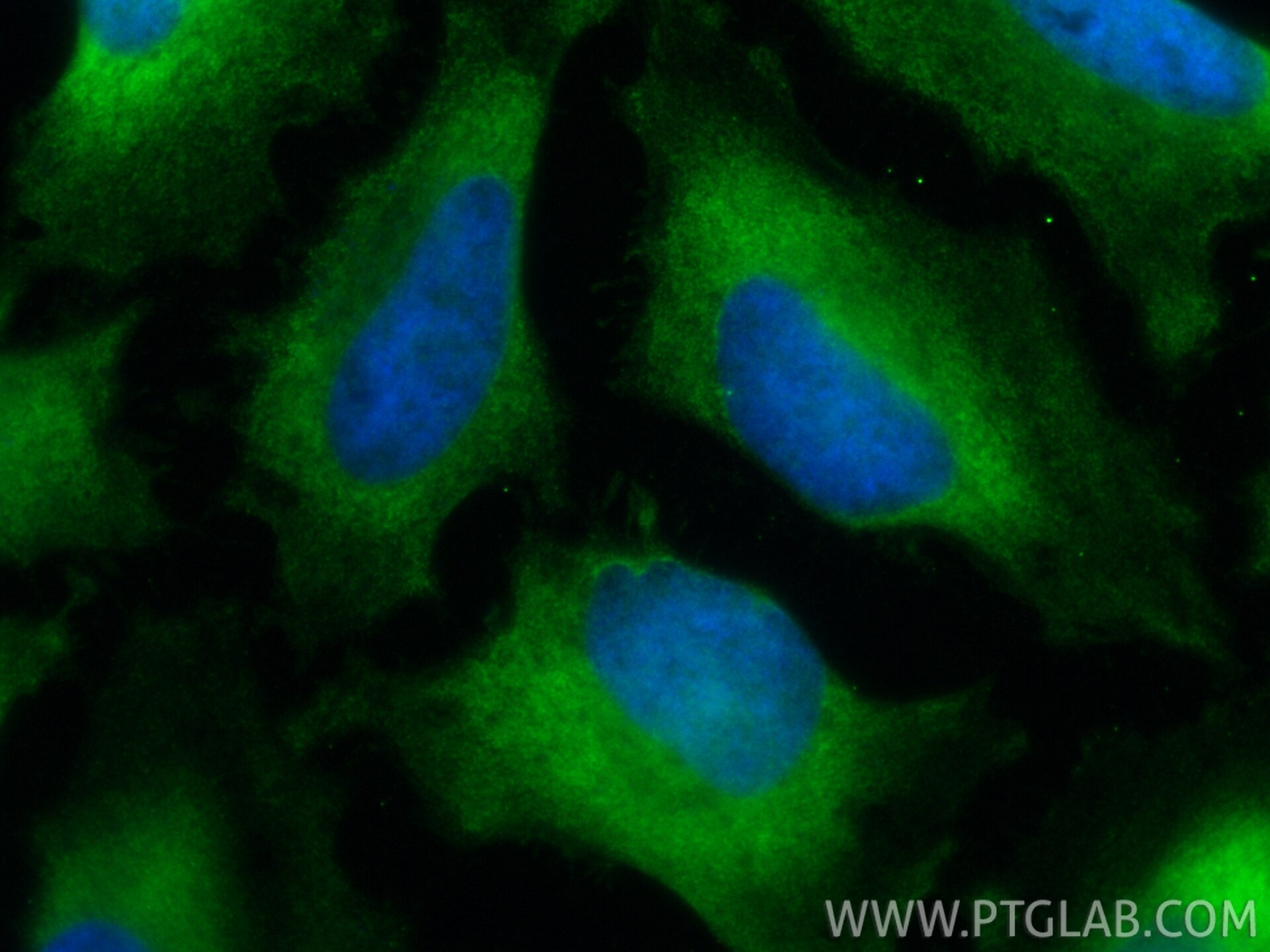 Immunofluorescent analysis of (-20°C Ethanol) fixed HeLa cells using CoraLite® Plus 488 GBP2 antibody (CL488-84264-6, Clone: 241580C12 ) at dilution of 1:100. Immunofluorescence (IF) / fluorescent staining of HeLa cells using CoraLite® Plus 488-conjugated GBP2 Recombinant mon (CL488-84264-6)