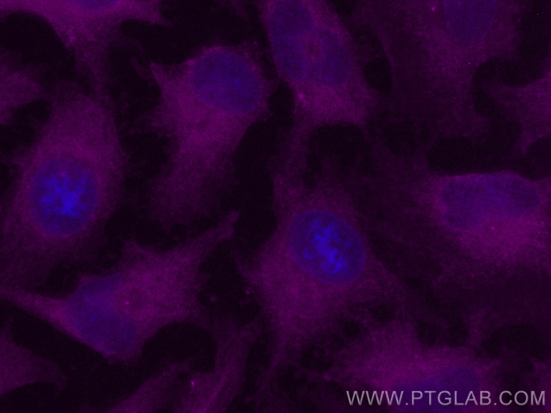 Immunofluorescence (IF) / fluorescent staining of HeLa cells using CoraLite® Plus 647-conjugated GBP2 Polyclonal anti (CL647-11854)