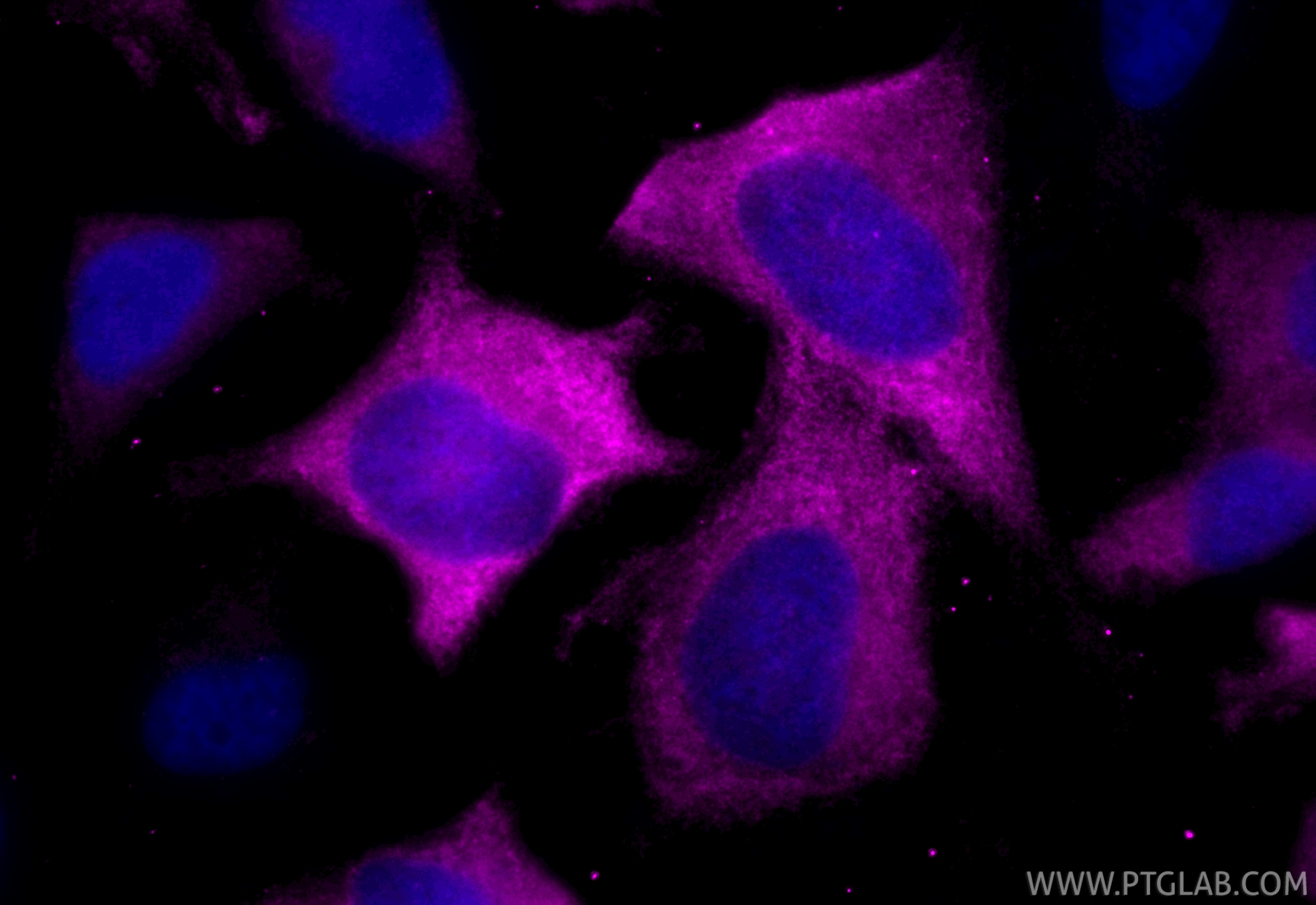 Immunofluorescent analysis of (-20°C Ethanol) fixed HeLa cells using CoraLite® Plus 647 GBP2 antibody (CL647-84264-6, Clone: 241580C12 ) at dilution of 1:200. Immunofluorescence (IF) / fluorescent staining of HeLa cells using CoraLite® Plus 647-conjugated GBP2 Recombinant mon (CL647-84264-6)