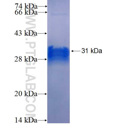 GBP2 fusion protein Ag25433 SDS-PAGE