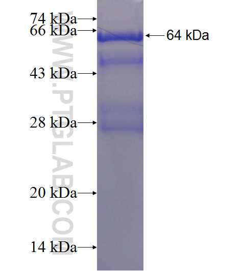 GBP2 fusion protein Ag2425 SDS-PAGE