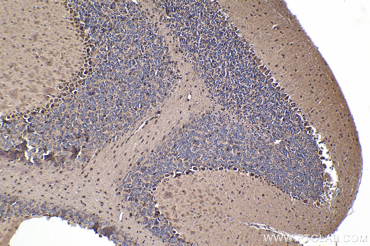 Immunohistochemistry (IHC) staining of mouse cerebellum tissue using GBP3 Polyclonal antibody (30719-1-AP)