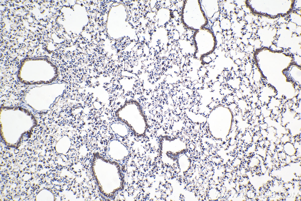 IHC staining of mouse lung using 30719-1-AP