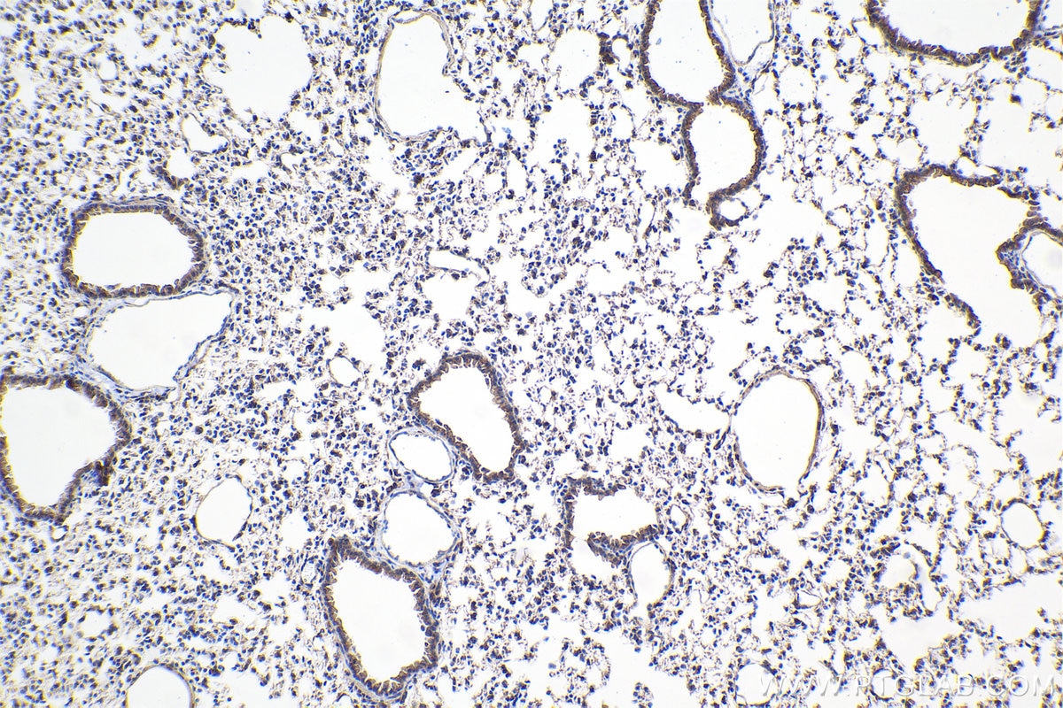 Immunohistochemistry (IHC) staining of mouse lung tissue using GBP3 Polyclonal antibody (30719-1-AP)