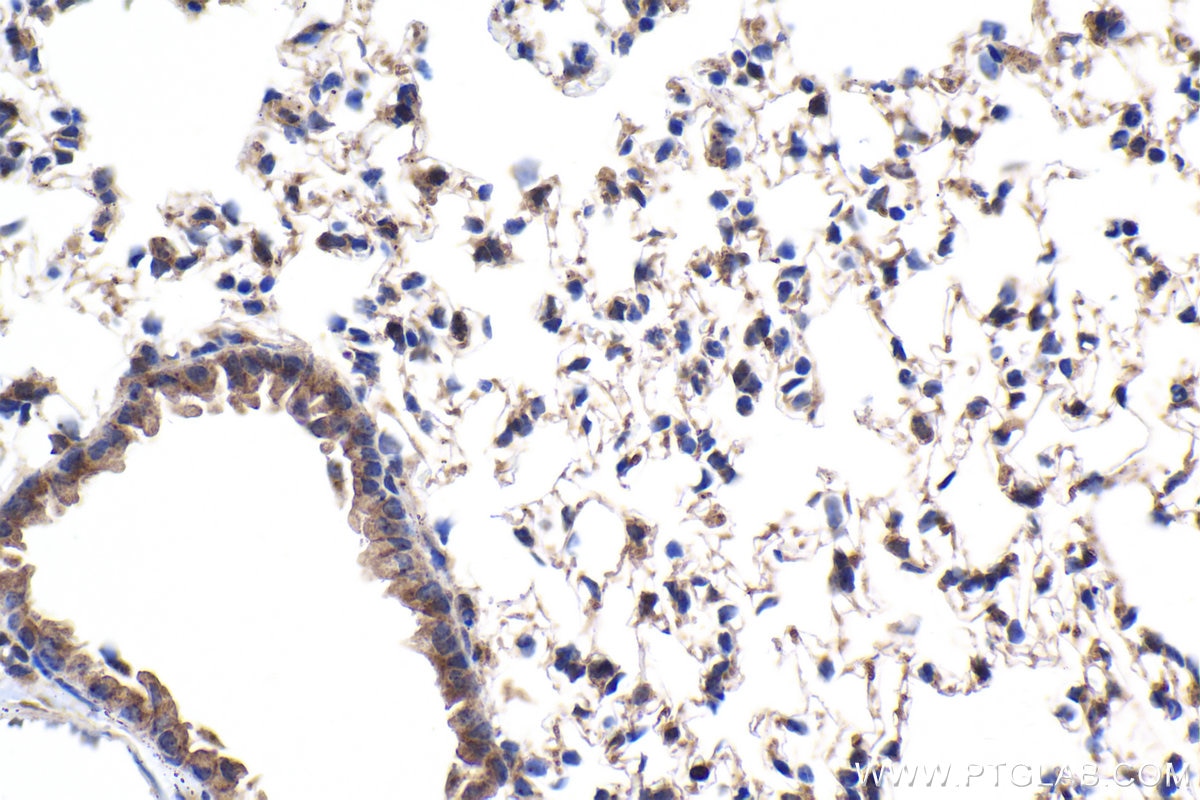 Immunohistochemistry (IHC) staining of mouse lung tissue using GBP3 Polyclonal antibody (30719-1-AP)