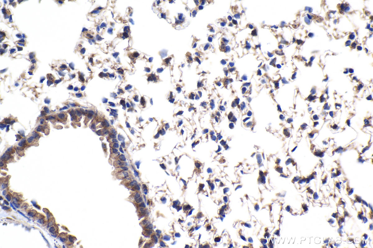 IHC staining of mouse lung using 30719-1-AP