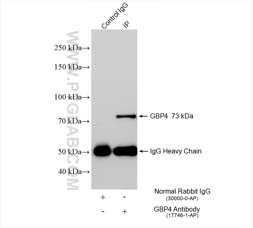 Immunoprecipitation (IP) experiment of A431 cells using GBP4 Polyclonal antibody (17746-1-AP)