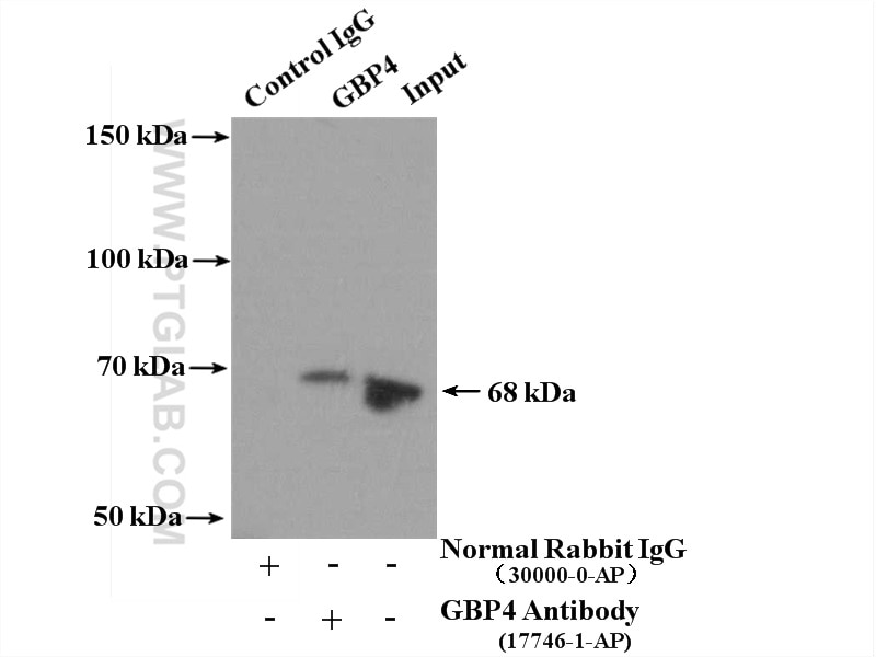 Immunoprecipitation (IP) experiment of A431 cells using GBP4 Polyclonal antibody (17746-1-AP)