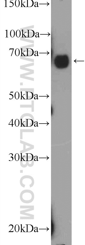 Western Blot (WB) analysis of A431 cells using GBP4 Polyclonal antibody (17746-1-AP)