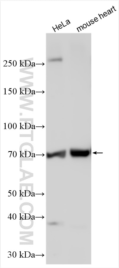 Western Blot (WB) analysis of various lysates using GBP4 Polyclonal antibody (17746-1-AP)
