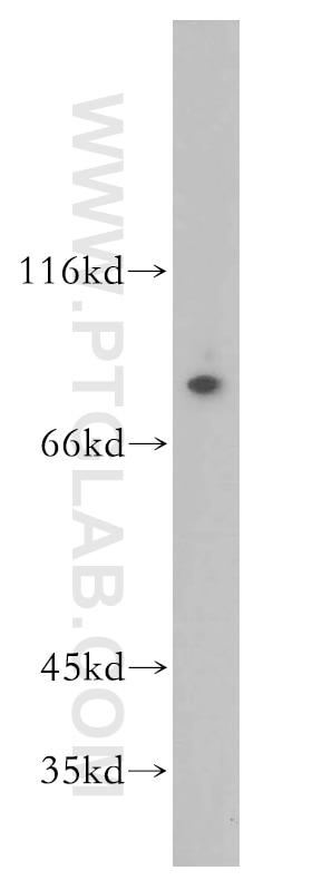 Western Blot (WB) analysis of human placenta tissue using GBP4 Polyclonal antibody (17746-1-AP)