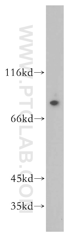 WB analysis of human placenta using 17746-1-AP