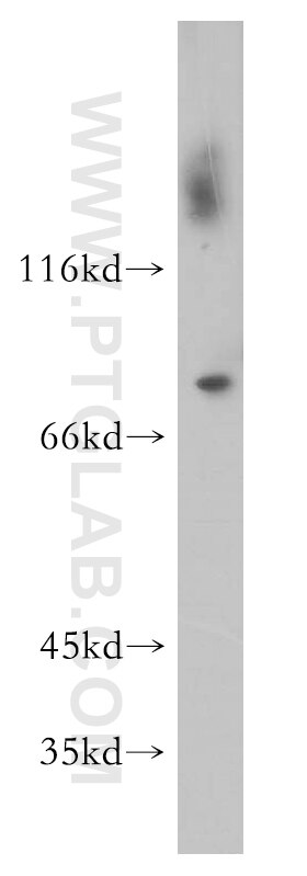 Western Blot (WB) analysis of A431 cells using GBP4 Polyclonal antibody (17746-1-AP)