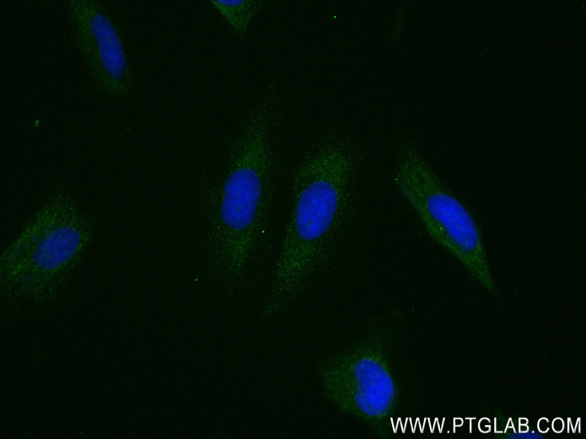 Immunofluorescence (IF) / fluorescent staining of HeLa cells using GBP4 Recombinant antibody (83699-2-RR)