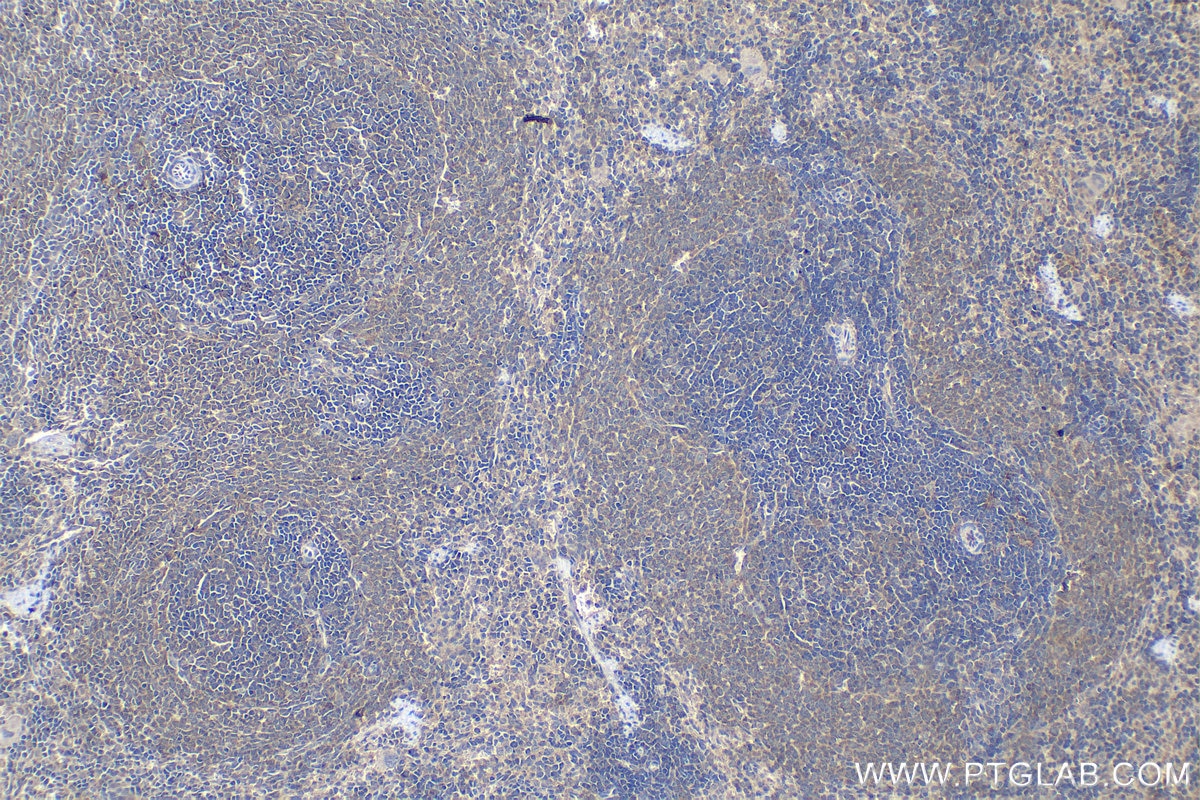Immunohistochemistry (IHC) staining of rat spleen tissue using GBP5 Polyclonal antibody (13220-1-AP)