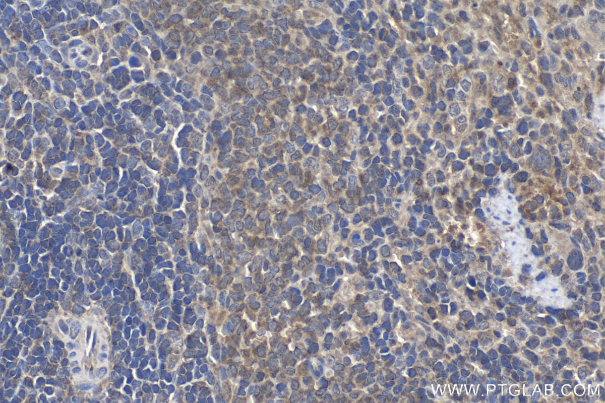 Immunohistochemistry (IHC) staining of rat spleen tissue using GBP5 Polyclonal antibody (13220-1-AP)