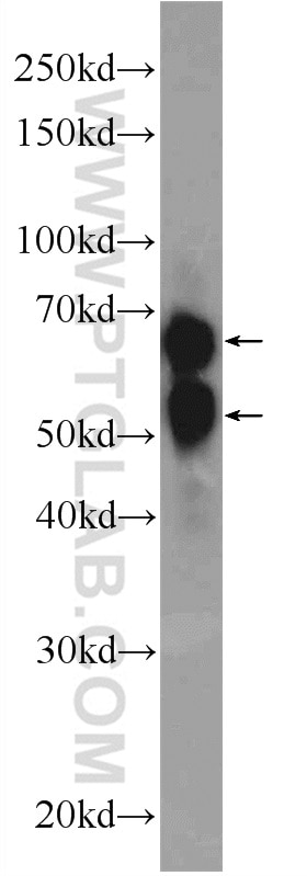 GBP5 Polyclonal antibody