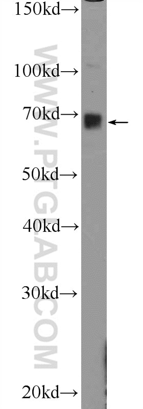 Western Blot (WB) analysis of Jurkat cells using GBP5 Polyclonal antibody (13220-1-AP)