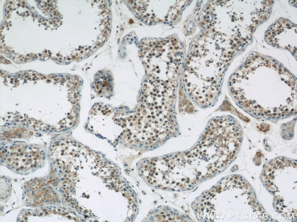 Immunohistochemistry (IHC) staining of human testis tissue using GBP6 Polyclonal antibody (23001-1-AP)