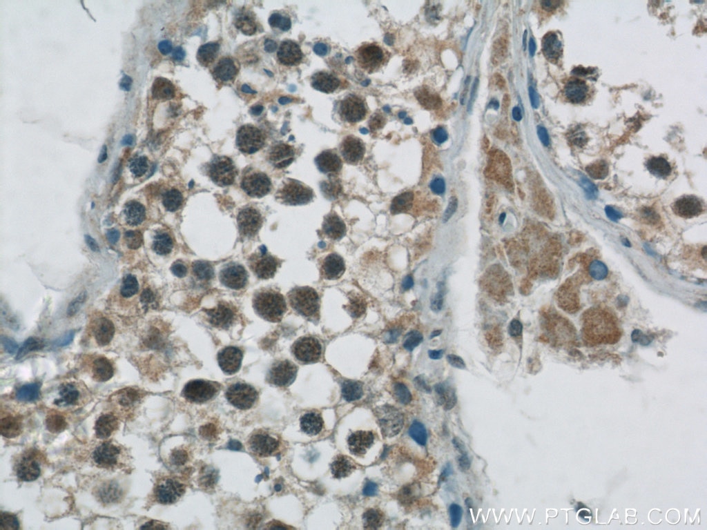 Immunohistochemistry (IHC) staining of human testis tissue using GBP6 Polyclonal antibody (23001-1-AP)
