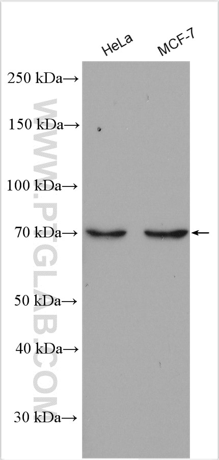 Western Blot (WB) analysis of HeLa cells using GBP6 Polyclonal antibody (23001-1-AP)