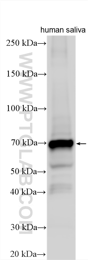 WB analysis using 23001-1-AP Western Blot (WB) analysis of various lysates using GBP6 Polyclonal antibody (23001-1-AP)
