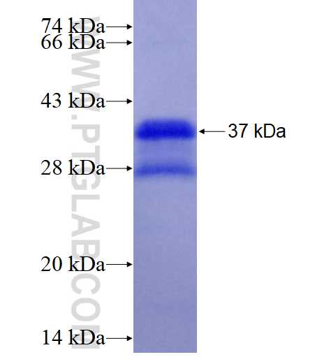 GBP6 fusion protein Ag19196 SDS-PAGE